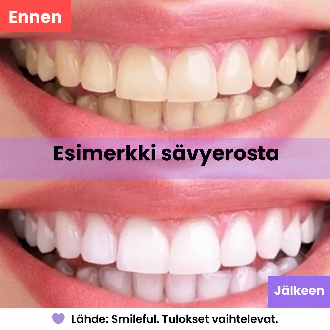 Havainnollistava esimerkki hampaiden sävyerosta